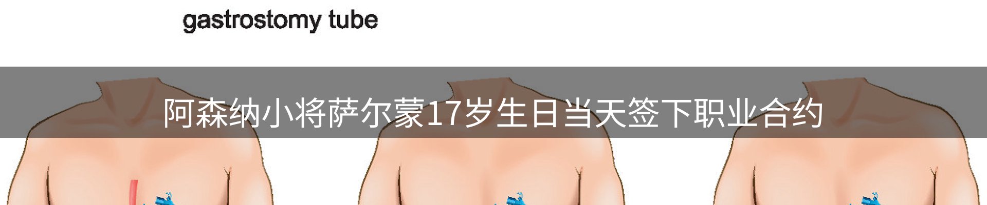 市场消息